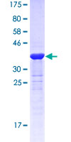 12.5% SDS-PAGE Stained with Coomassie Blue